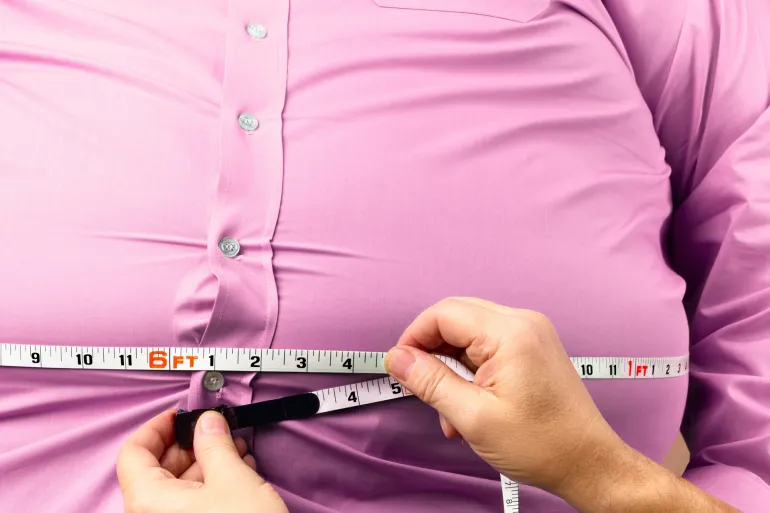 obesity